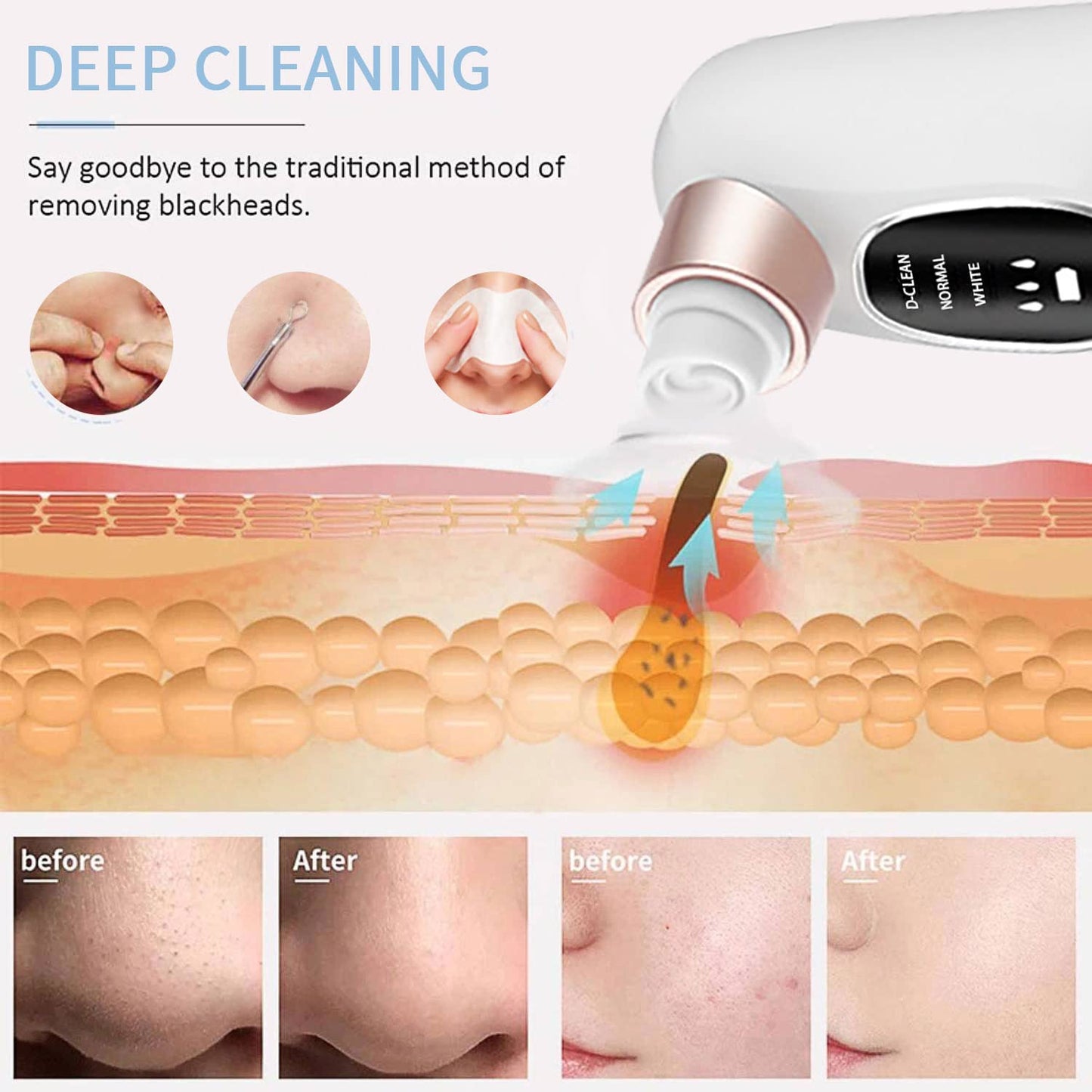 Azra Aqua Vacuum Pore Cleaner | Mini Hydra Facial Device